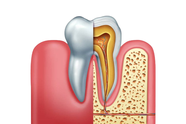 RootCanal img